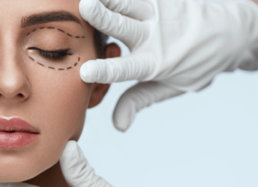 blefaroplastia em florianópolis